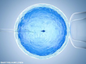 单身生育力保存